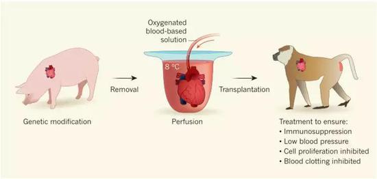 研究提供的器官保存和灌流系統對人類器官移植具有重要啟示。圖片來源：Success for cross-speciesheart transplants